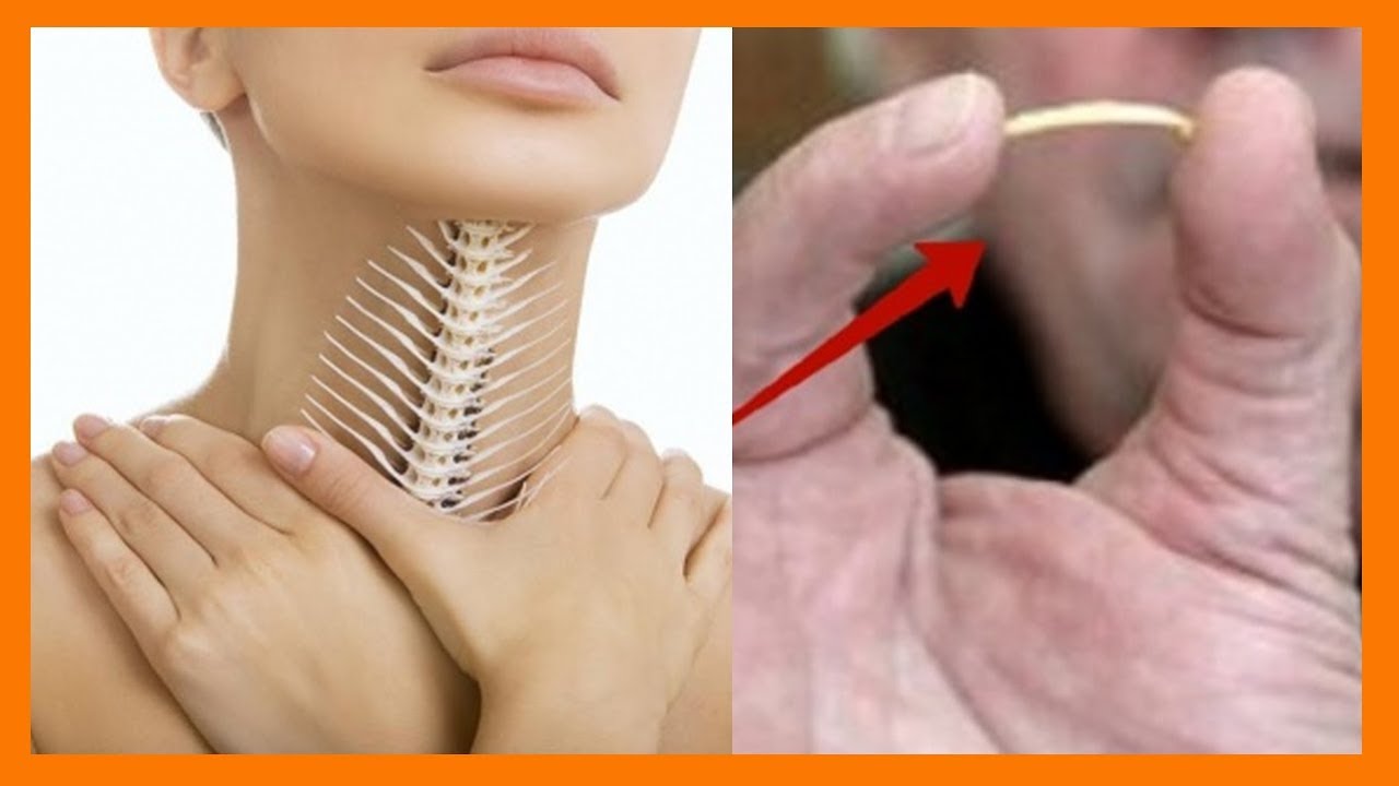 Trị hóc xương cá tại nhà hiệu quả
